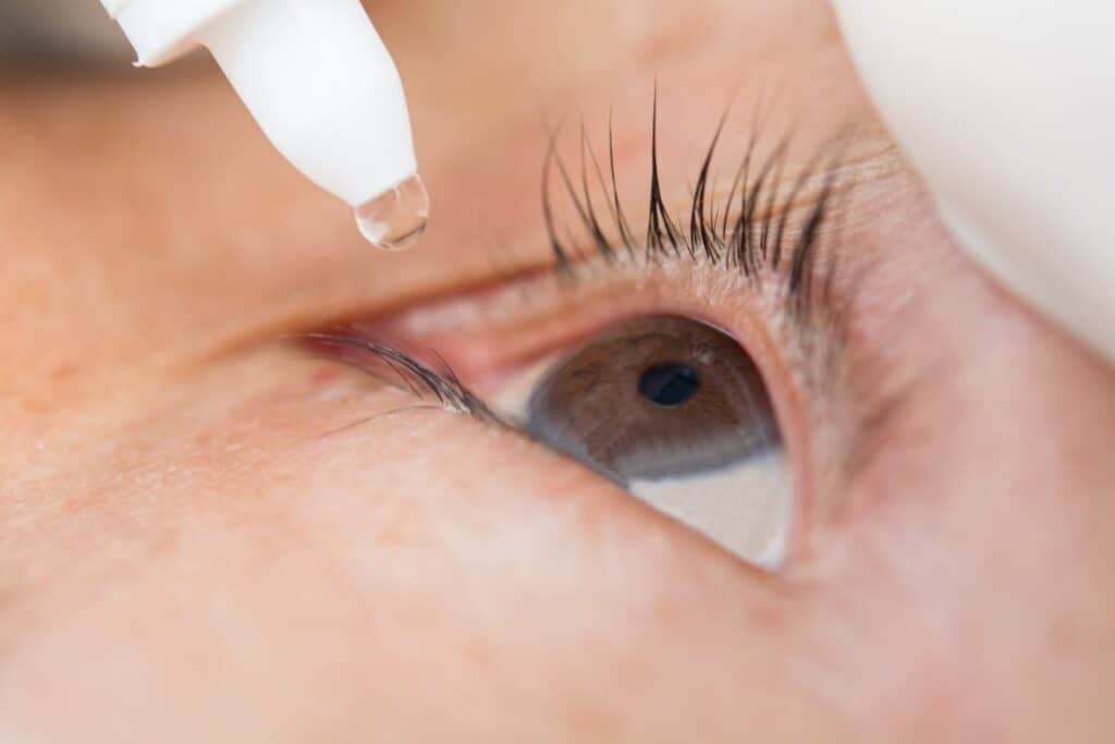 Using eye drops to reduce your redness