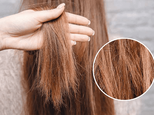 Your hair will not grow back after chemical damage. 