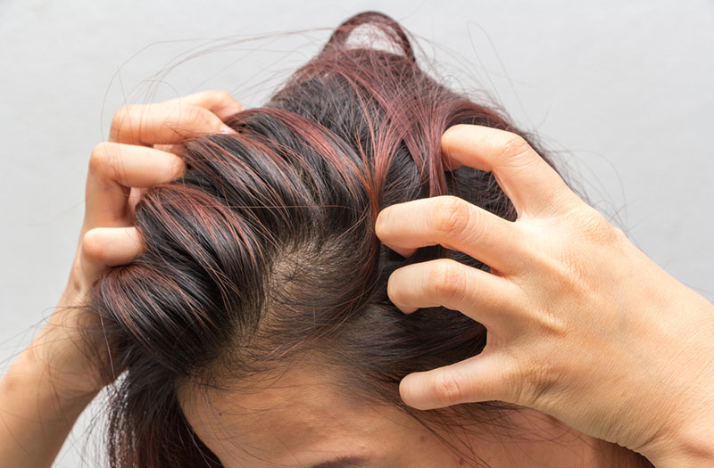 Using expired Splat hair dye may cause allergic reactions 